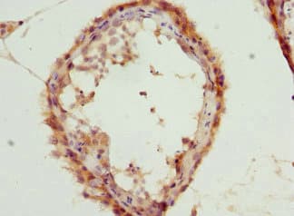 Polyclonal Rabbit anti-Human LGALS8 / Galectin 8 Antibody (IHC)