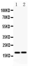 CASP8 / Caspase 8 Antibody (aa257-277)