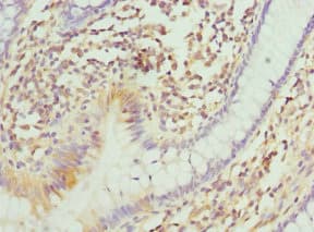 ITGB3BP Antibody