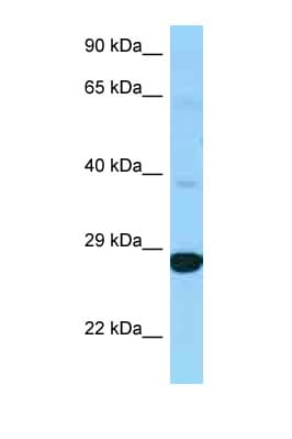 Polyclonal Rabbit anti-Human DHRS4L2 Antibody (C-Terminus, WB)