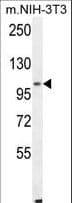 IHC-plus™ ALDH1L2 Antibody (aa743-772)