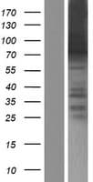 ARID3B Protein (Over-Expression Lysate Myc-DDK (Flag))