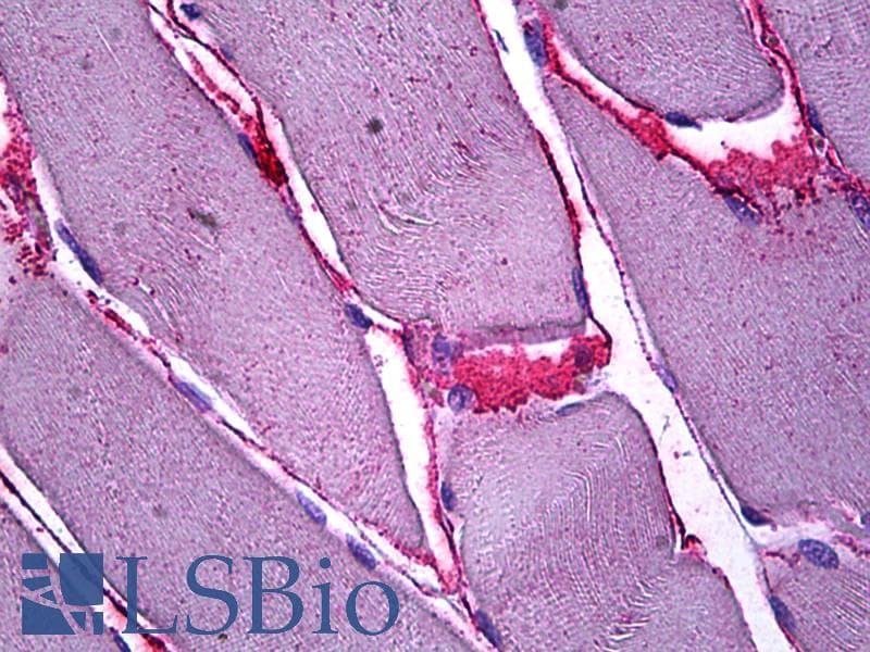 IHC-plus™ SFRP4 Antibody (aa239-253)