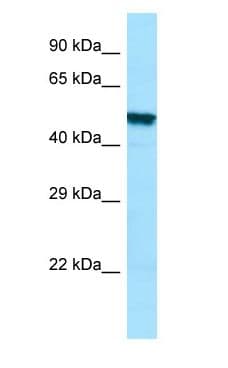 Polyclonal Rabbit anti-Human PLA2G3 Antibody (C-Terminus, WB)
