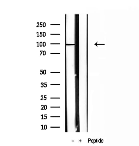 Polyclonal Rabbit anti-Human NSUN2 Antibody (IHC, IF, WB)