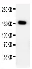 Polyclonal Rabbit anti-Human PTCH2 / Patched 2 Antibody (aa885-901, WB)