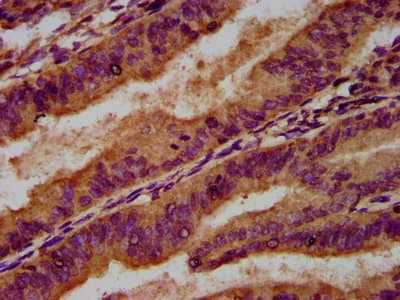 GCK / Germinal Center Kinase Antibody