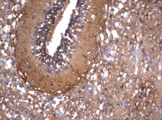 NCAM / CD56 Antibody (aa20-718, clone UMAB83, Carrier-free)