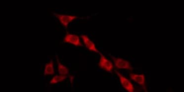 Polyclonal Rabbit anti-Human GIMAP2 Antibody (IF, WB)