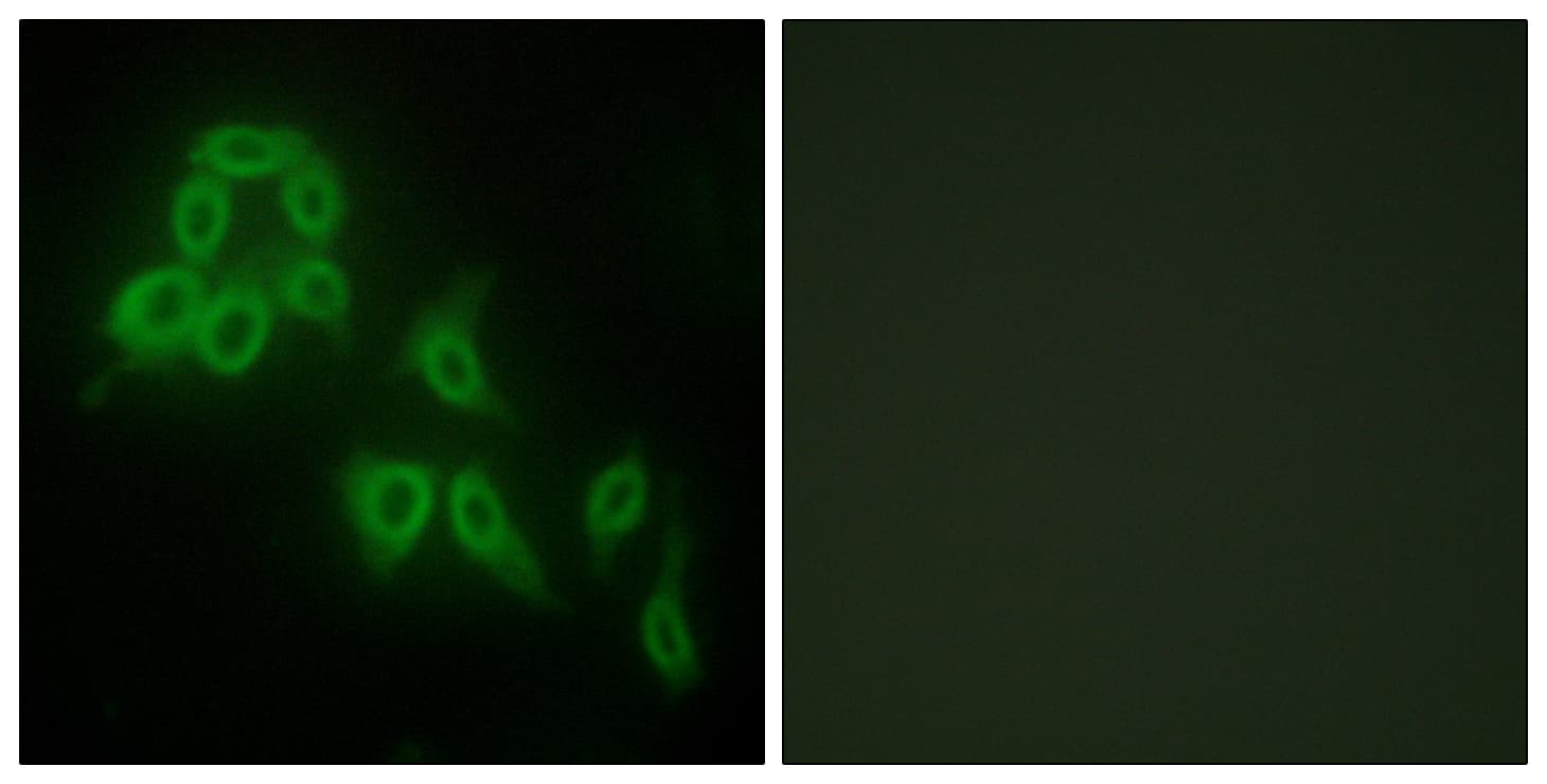IHC-plus™ COL5A2 / Collagen V Alpha 2 Antibody (aa1-50)