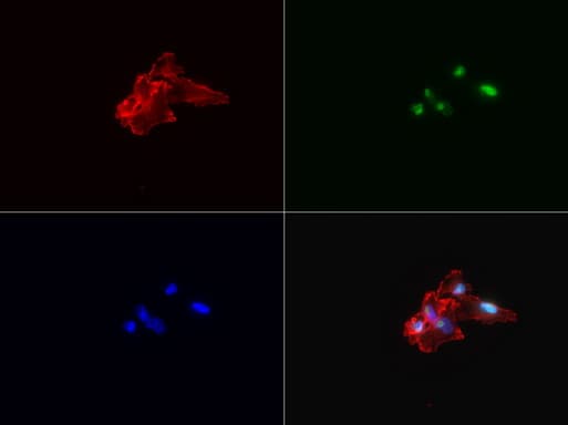 MKI67 / Ki67 Antibody (aa1160-1493, clone UMAB107)