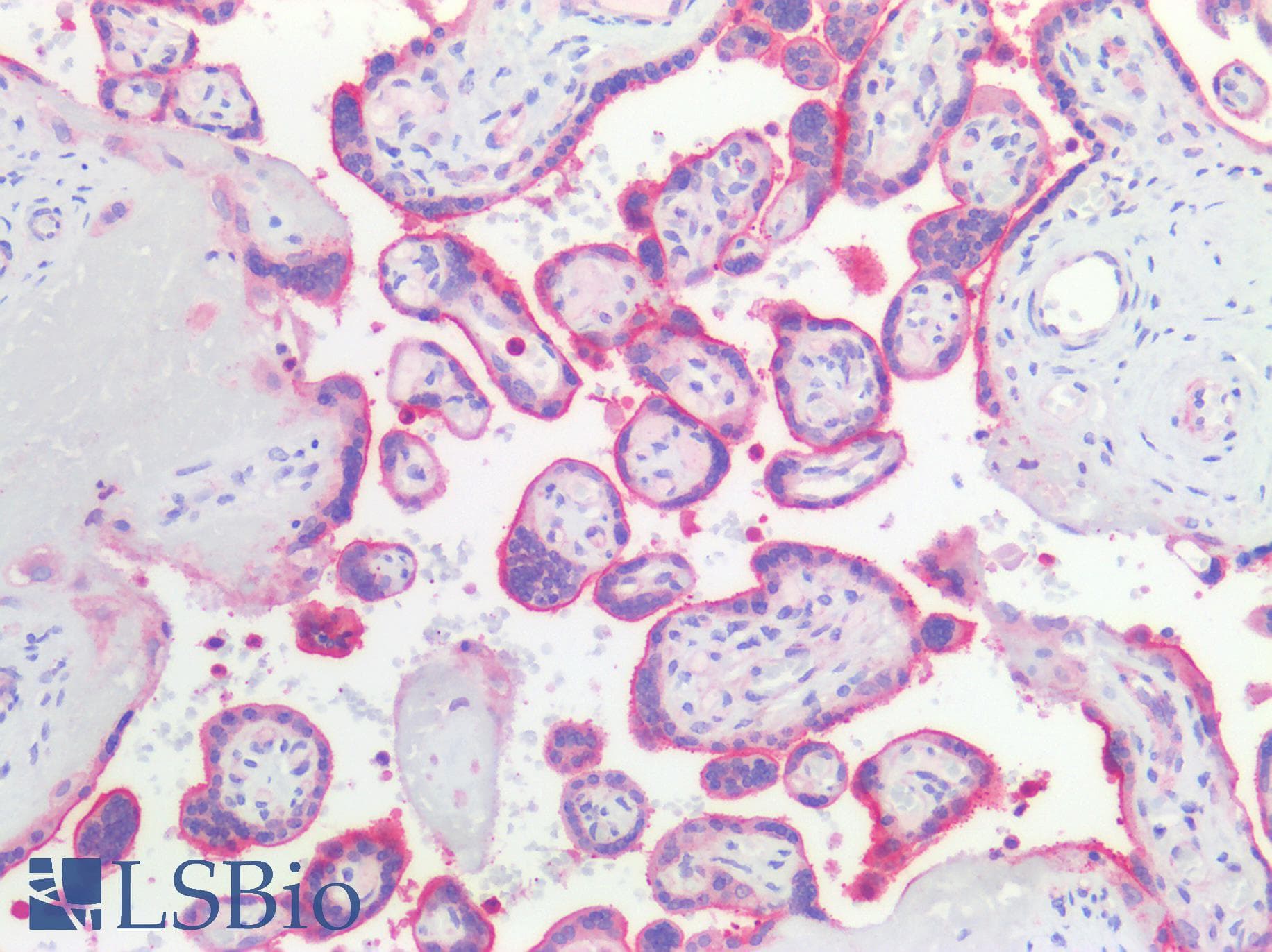 IHC-plus™ Polyclonal Rabbit anti-Human PVRL4 / Nectin 4 Antibody (aa371-510, IHC, WB)