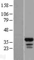 FAM133B Protein (Over-Expression Lysate Myc-DDK (Flag))