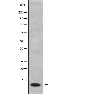 Polyclonal Rabbit anti-Human FXYD2 Antibody (WB)