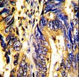 Polyclonal Rabbit anti-Human AXL Antibody (IHC, WB)