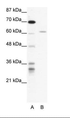 Polyclonal Rabbit anti-Human IKZF4 / EOS Antibody (HRP, aa97-146, WB)