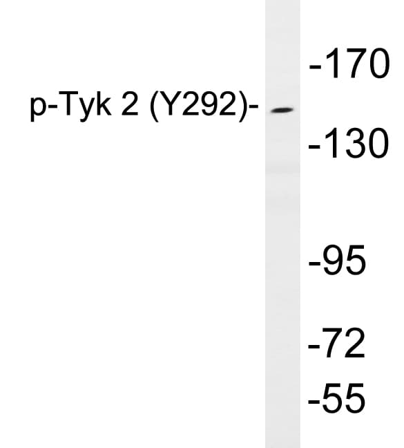 TYK2 Antibody (phospho-Tyr292)