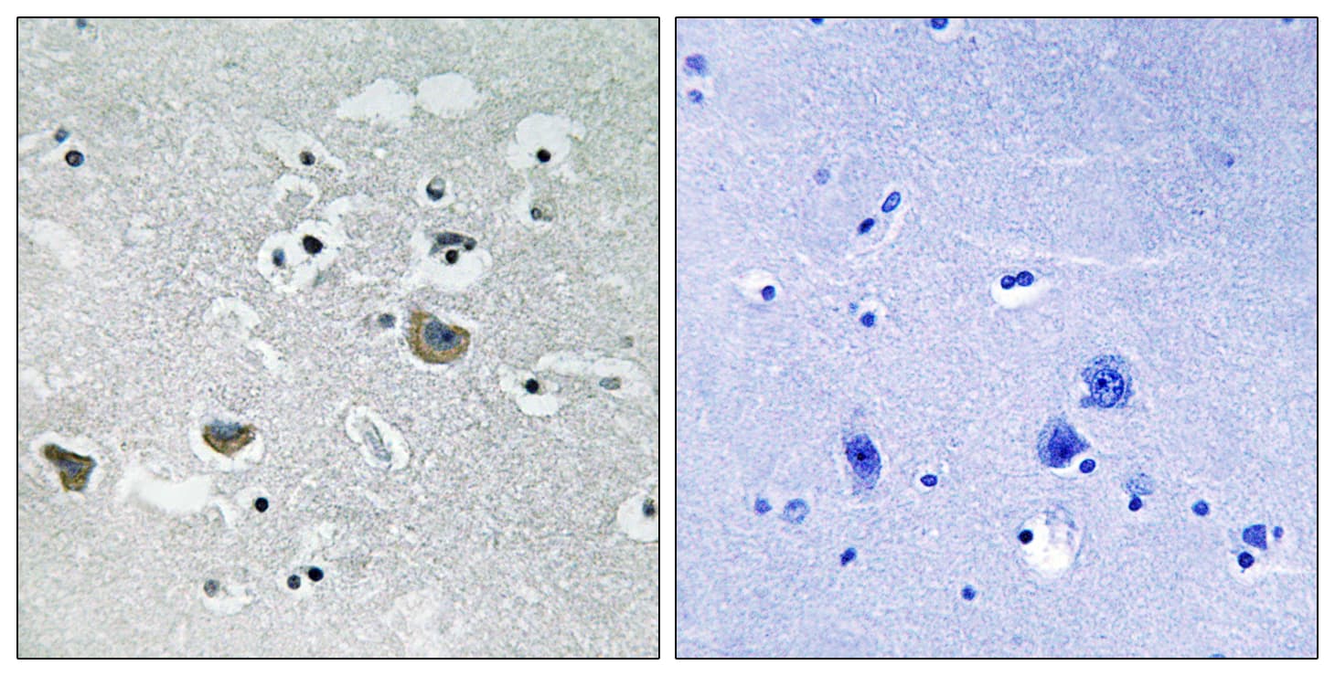Polyclonal Rabbit anti-Human SREBF1 / SREBP-1 Antibody (aa405-454, IHC, WB)