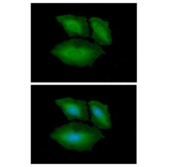 XPA Antibody (clone AT71H3)