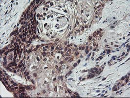 FMR1 / FMRP Antibody (clone OTI2C3)