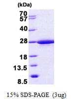 Human IFT22 / RABL5 Protein (Recombinant His)