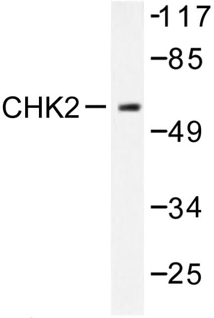 CHEK2 / CHK2 Antibody (Ser379)