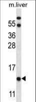 Polyclonal Rabbit anti-Human UQCRB Antibody (aa34-61, WB)