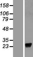 Human LCN9 Protein (Over-Expression Lysate Myc-DDK (Flag))