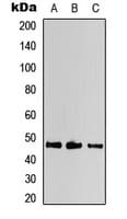 PathPlus™ KCNJ2 / Kir2.1 Antibody (Internal)