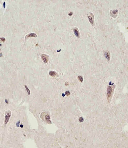 FAM216B Antibody (aa106-139)
