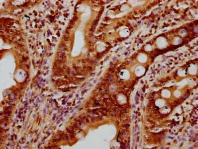 HIST1H2BN Antibody