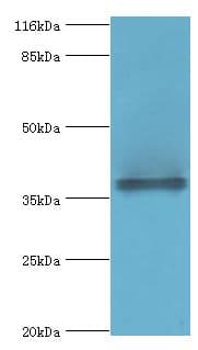 Polyclonal Rabbit anti-Human CYLC2 Antibody (WB)