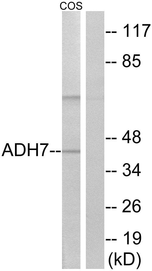 Polyclonal Rabbit anti-Human ADH7 Antibody (WB)