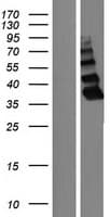 ZBTB8B Protein (Over-Expression Lysate Myc-DDK (Flag))