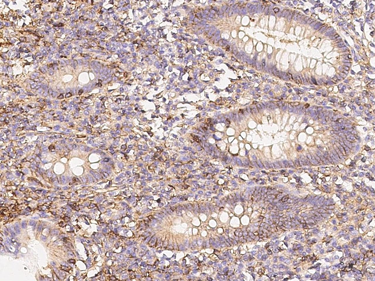 Monoclonal Rabbit anti-Human CD58 Antibody (clone 126, Preservative Free, IHC)