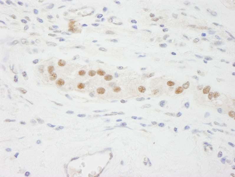KPNA3 / Importin Alpha 4 Antibody (aa1-50)