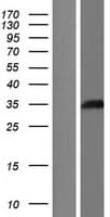LCMT1 Protein (Over-Expression Lysate Myc-DDK (Flag))