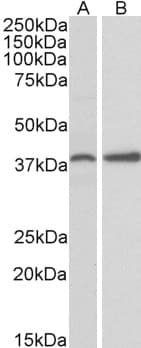 IHC-plus™ PRKCDBP / CAVIN3 Antibody (aa179-190)