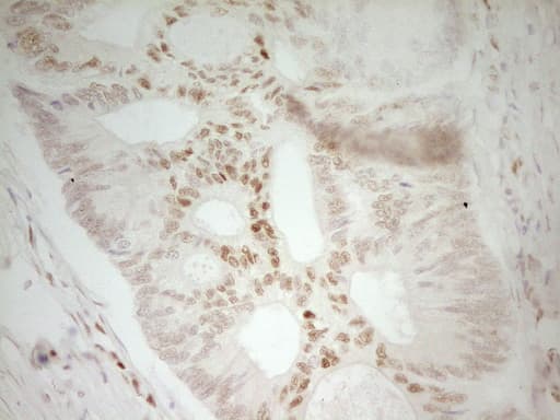 MEF2D Antibody (aa1-282, clone OTI3D12)