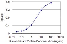 IHC-plus™ ABCC4 / MRP4 Antibody (clone 1B2)