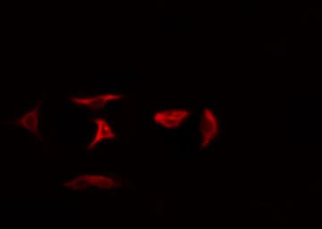Polyclonal Rabbit anti-Human RPL5 / Ribosomal Protein L5 Antibody (IF, WB)