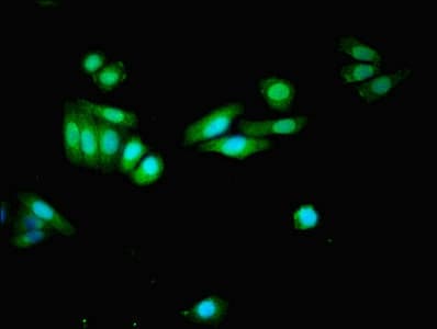Polyclonal Rabbit anti-Human SLC1A7 / EAAT5 Antibody (IHC, IF)
