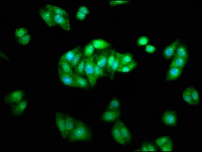 ARRB1 / Beta Arrestin 1 Antibody