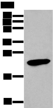 Polyclonal Rabbit anti-Human GKN1 / Gastrokine 1 Antibody (IHC, WB)