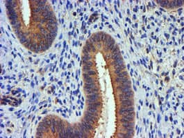 TUBAL3 Antibody (aa150-446, clone OTI4D9, Carrier-free)