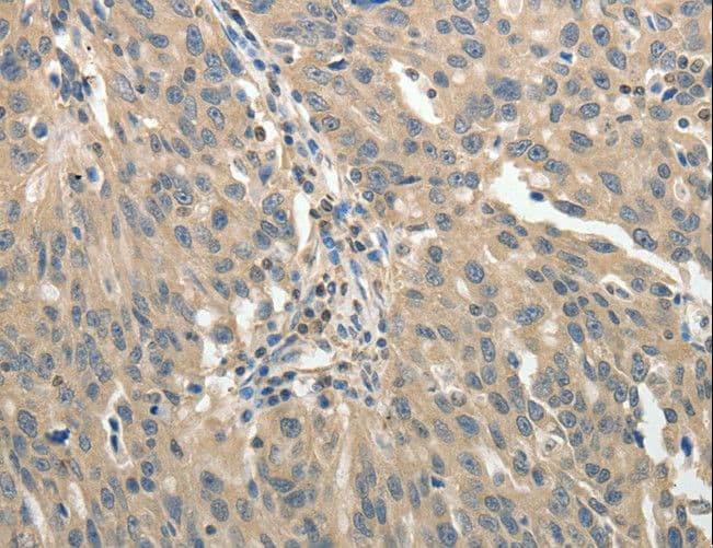 GSR / Glutathione Reductase Antibody