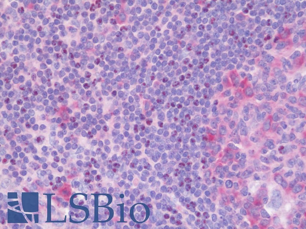 IHC-plus™ FGF18 Antibody (aa23-50)