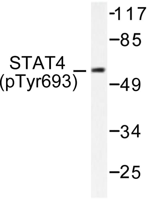 STAT4 Antibody (phospho-Tyr693)