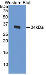 LRP1 / CD91 Antibody (aa692-962, Biotin)
