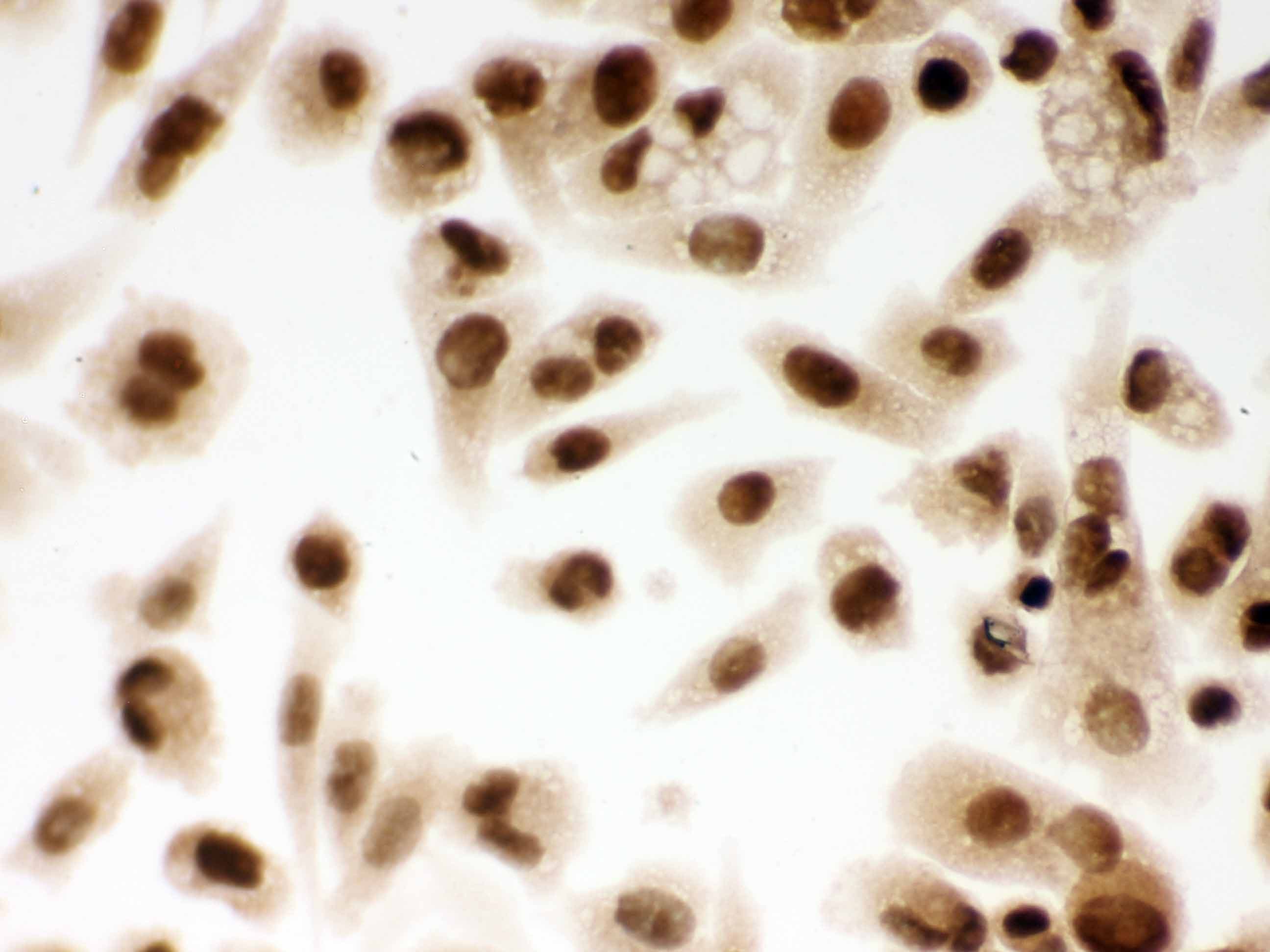 DDB1 Antibody (aa1011-1140)